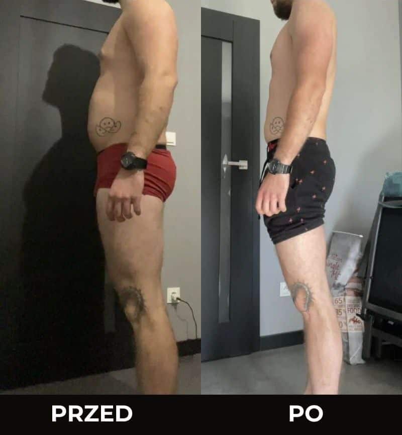 Metamorfoza podopiecznego